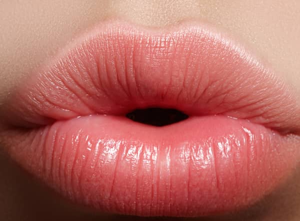 How to get rids of chapped lips