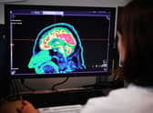 The research was conducted by scientists at the University of Edinburgh. 