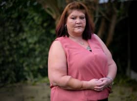 Rachel Anderson of Skegness, Lincolnshire after recovering from a horrific dog attack.