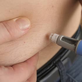 One in three Scots are obese
