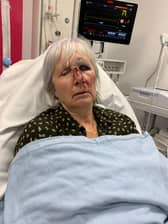 Glenn Lilley after she fell face first into the door as she collapsed before the tumour was discovered. 