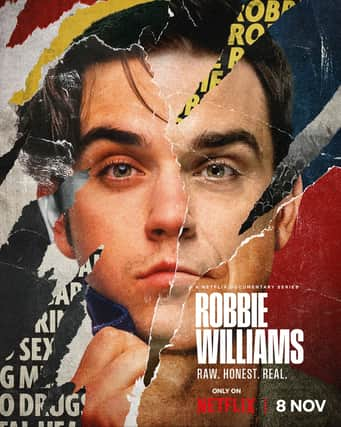 Robbie Williams is the latest pop star to see his life and career transformed into a Netflix documentary. Cr. Netflix