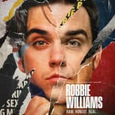 Robbie Williams is the latest pop star to see his life and career transformed into a Netflix documentary. Cr. Netflix