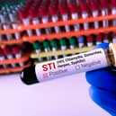 Clinics offering contraception are having to be cancelled because they are “flooded out” with cases of STIs such as gonorrhoea. Image: Adobe.