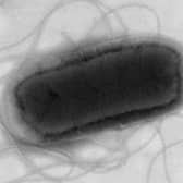 The UK Health Security Agency (UKHSA) has reported that an E. coli outbreak, suspected to be associated with a nationally distributed food item or several items.