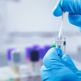 Scottish scientists have been developing a potential new treatment for brain disorders - by infecting people with parasites.