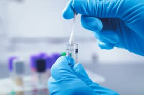 Scottish scientists have been developing a potential new treatment for brain disorders - by infecting people with parasites.