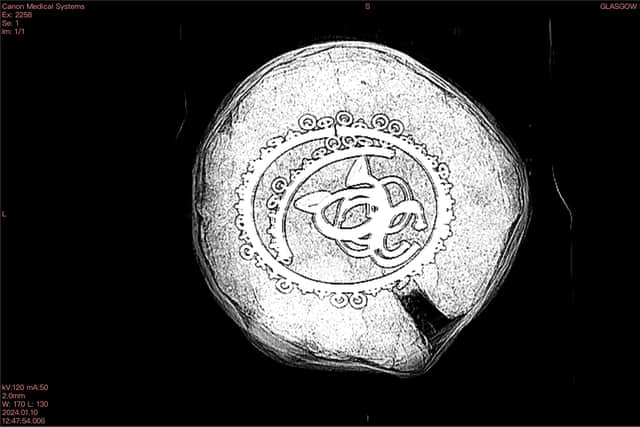An X-ray image of the Bronze Age hoard of necklaces and bracelets. PIC: GUARD Archaeology.