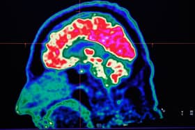 Tiny robots could be sent inside the brain to make life-saving repairs (Picture: Fred Tanneau)