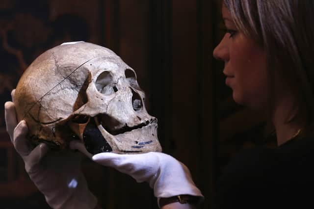 According to the pseudoscientific theory of 'phrenology', the shape of someone's skull could reveal their character (Picture: Oli Scarff/Getty)