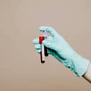 Cases of HIV amongst heterosexual patients in England have risen by more than 30% since 2022.