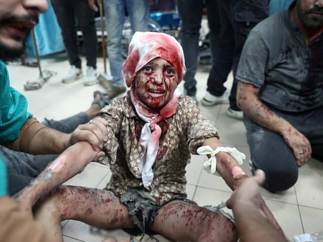 An injured child receives medical attention at the al Aqsa Martyrs hospital after an Israeli missile strike in Deir al-Balah, Gaza, earlier this month (Picture: Eyad Baba)