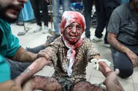 An injured child receives medical attention at the al Aqsa Martyrs hospital after an Israeli missile strike in Deir al-Balah, Gaza, earlier this month (Picture: Eyad Baba)