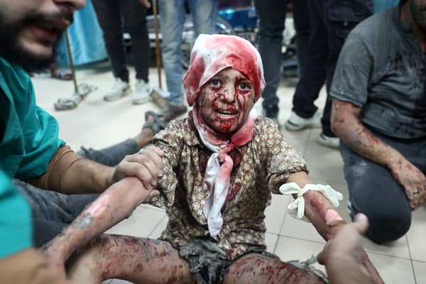 An injured child receives medical attention at the al Aqsa Martyrs hospital after an Israeli missile strike in Deir al-Balah, Gaza, earlier this month (Picture: Eyad Baba)