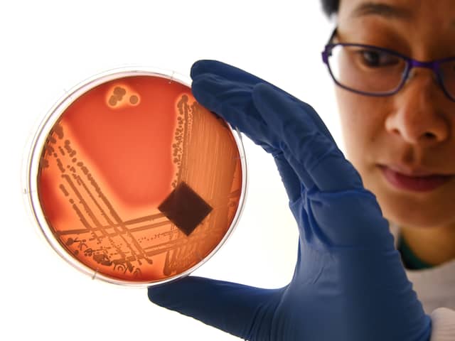 Superbugs like Staphylcocus epidermidis could kill eight million people a year by 2050 (Picture: William West)