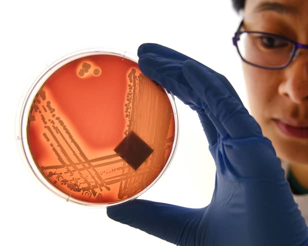 Superbugs like Staphylcocus epidermidis could kill eight million people a year by 2050 (Picture: William West)