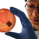 Superbugs like Staphylcocus epidermidis could kill eight million people a year by 2050 (Picture: William West)