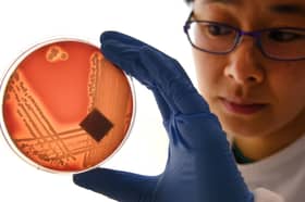 Superbugs like Staphylcocus epidermidis could kill eight million people a year by 2050 (Picture: William West)