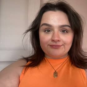 Brooke MacFadyen, 24, from Coatbridge, underwent Awake Craniotomy. Picture: NHSGGC