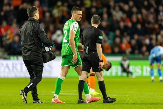 Lewis Miller is a doubt for Hibs.