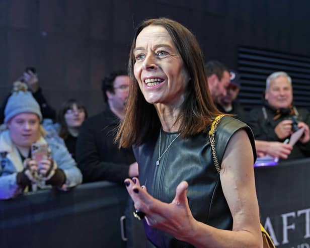 Kate Dickie has been made a patron of prestigious arts conservatoire of the Junior Conservatoire of Drama, Production and Film of the Royal Conservatoire of Scotland