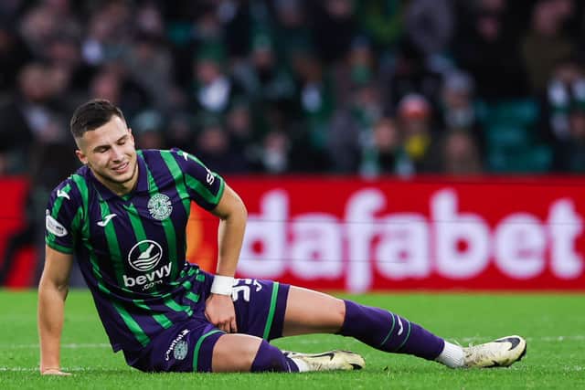 It was not a good afternoon for Hibs striker Mykola Kuharevich.