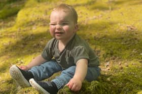 Levi Lithgow, who has been left blind in one eye