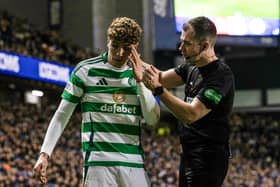 Referee Don Robertson checks on the condition of Celtic midfielder Arne Engels after he was struck with a coin thrown by a Rangers fan.