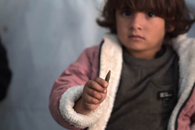 Little Razan holding the bullet that was surgically removed from her neck.