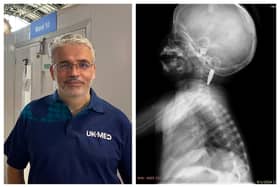 David Anderson and the CT scan of Razan