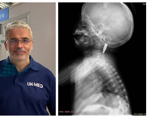 David Anderson and the CT scan of Razan