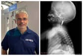 David Anderson and the CT scan of Razan