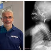 David Anderson and the CT scan of Razan