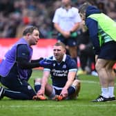 Finn Russell receives medical treatment following his collision with Scotland team-mate Darcy Graham.