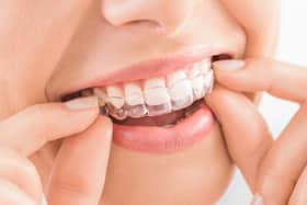 Invisalign