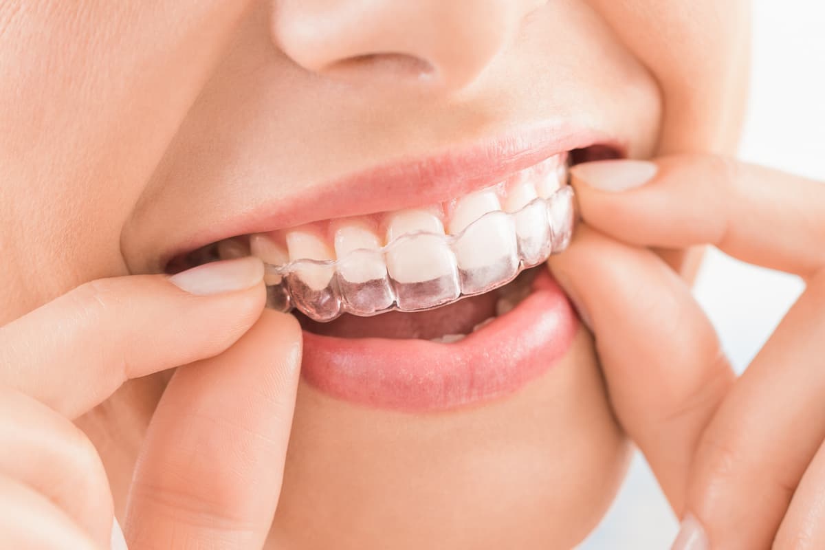 I went back to teenage braces on my teeth and it's the best thing I ever did