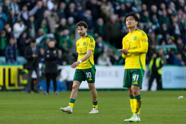 Celtic suffered a rare defeat last time they played Hibs.