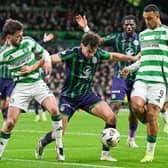 Celtic and Hibs both have injury concerns ahead of this weekend Scottish Premiership clash at Celtic Park. Cr: SNS Group.