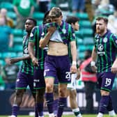 Hibs were defeated 3-1 by Celtic.