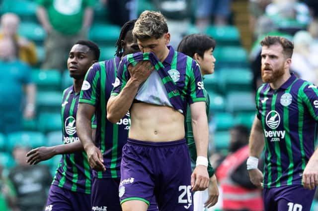 Hibs were defeated 3-1 by Celtic.