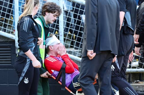 Aberdeen's Jack MacKenzie receives treatment after being hit with an object from the crowd at the end of the 2-1 defeat at Dundee United. (Photo by Roddy Scott / SNS Group)