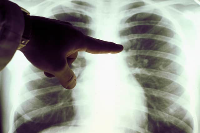 Catching and treating cancer quickly can save lives