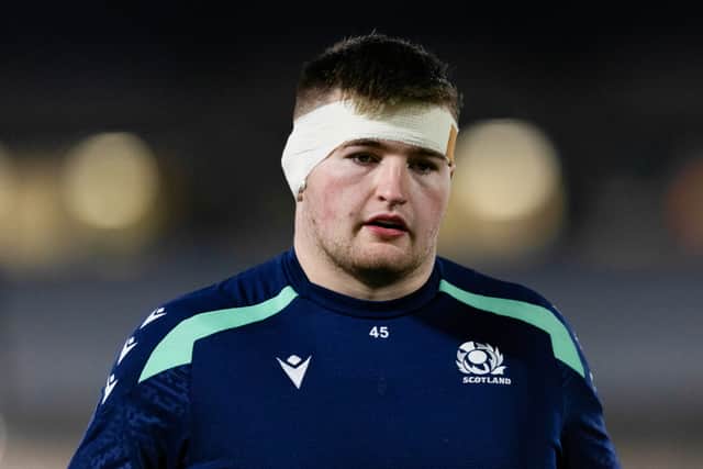 Scotland's Ollie Blyth-Lafferty had to go off for stitches during the World Rugby U20 Championship match with England.