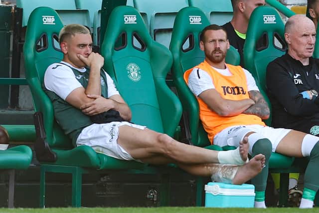 Hibs' Lewis Miller was taken off with an injury.