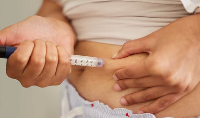 It comes as obesity affects over 1 in 4 adults in the UK