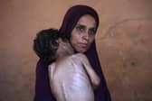 Naeema, pictured on Wednesday, holds her malnourished two-year-old son Yazan in their damaged home in the Al-Shati refugee camp, west of Gaza City (Picture: Omar Al-Qattaa)
