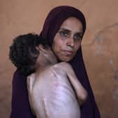 Naeema, pictured on Wednesday, holds her malnourished two-year-old son Yazan in their damaged home in the Al-Shati refugee camp, west of Gaza City (Picture: Omar Al-Qattaa)