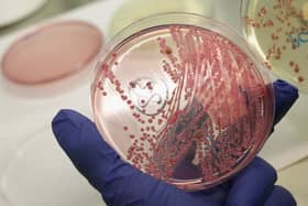 Cases of a deadly strain of E.coli rose by 26% last year.