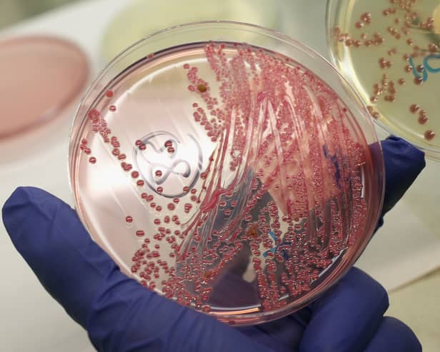 Cases of a deadly strain of E.coli rose by 26% last year.