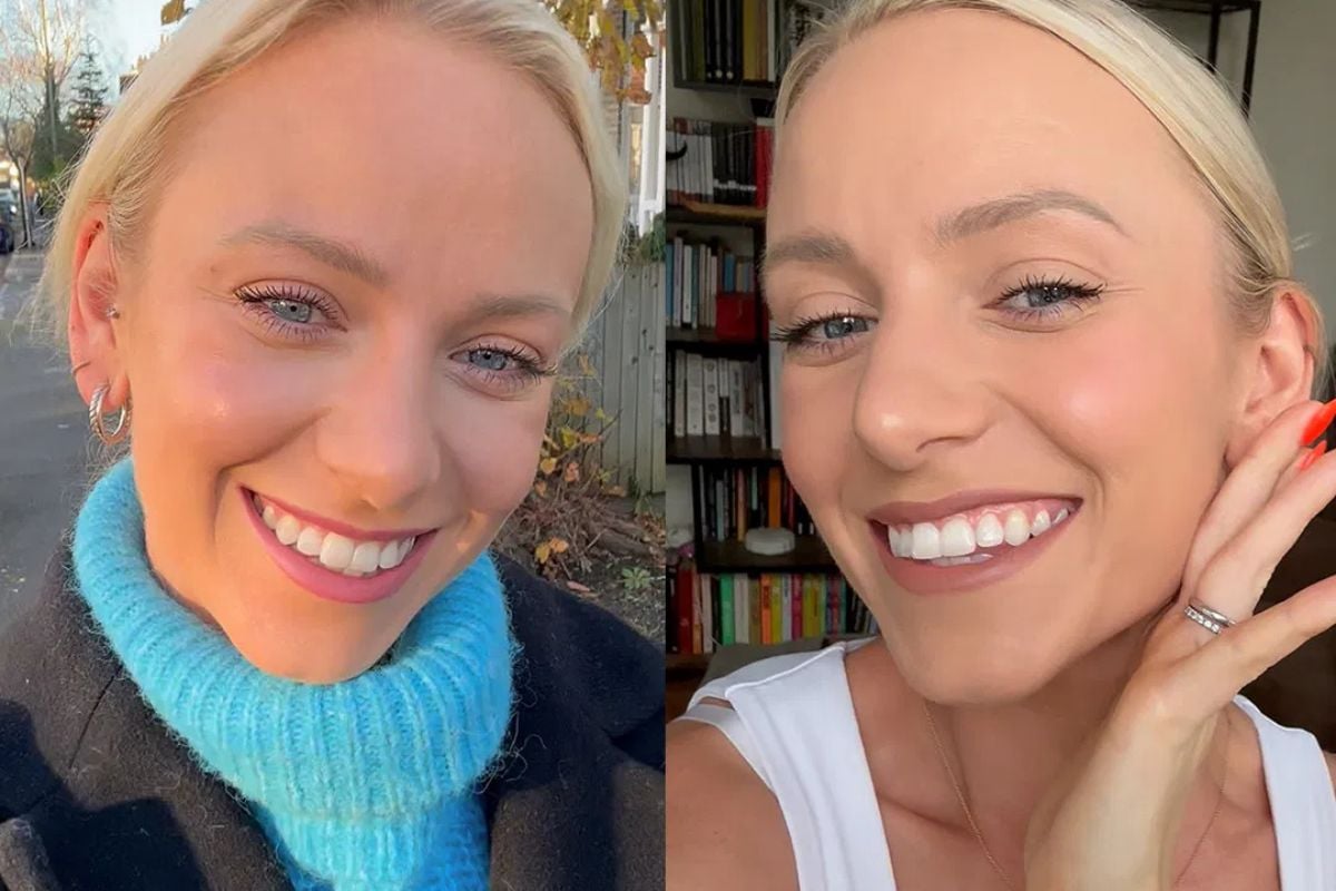 I Tried MySweetSmile to Whiten My Teeth - No Trip to Turkey Needed